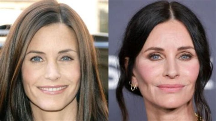 Courteney Cox's Botched Plastic Surgery